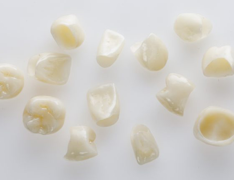 茗荷谷駅徒歩2分の歯医者｜佐藤歯科医院の保険適用の白い歯