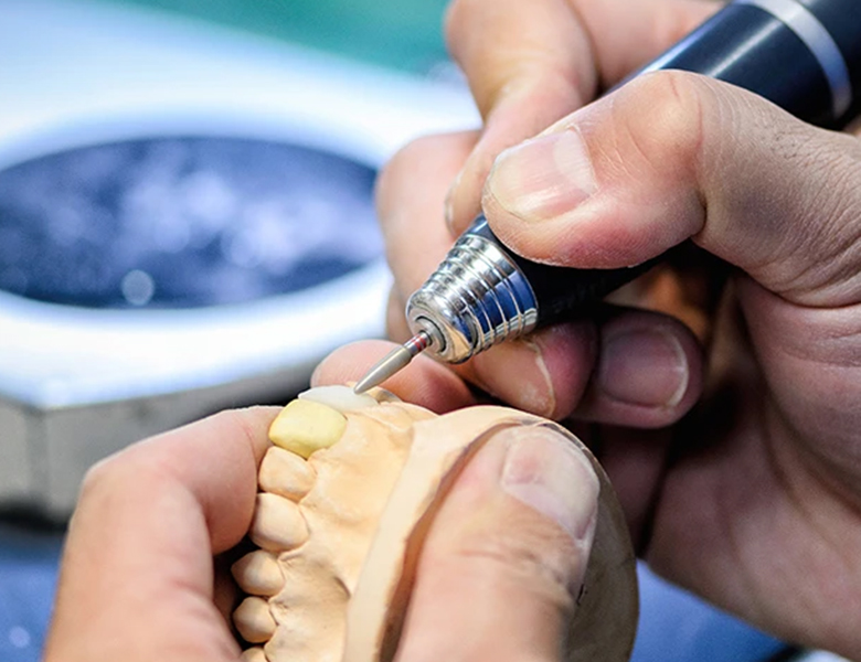 茗荷谷駅徒歩2分の歯医者｜佐藤歯科医院の審美歯科