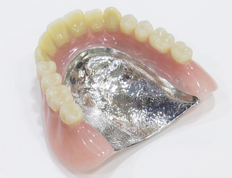 茗荷谷駅徒歩2分の歯医者｜佐藤歯科医院の入れ歯治療