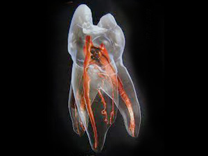 茗荷谷駅徒歩2分の歯医者｜佐藤歯科医院のむし歯治療